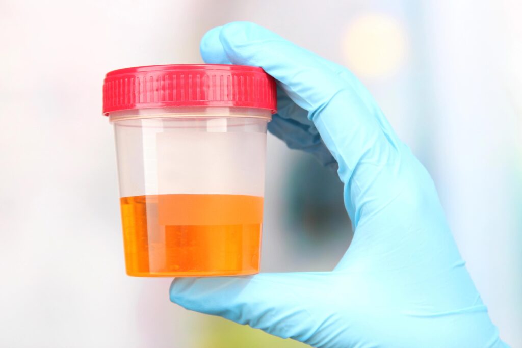 how long is alcohol detectable in urine